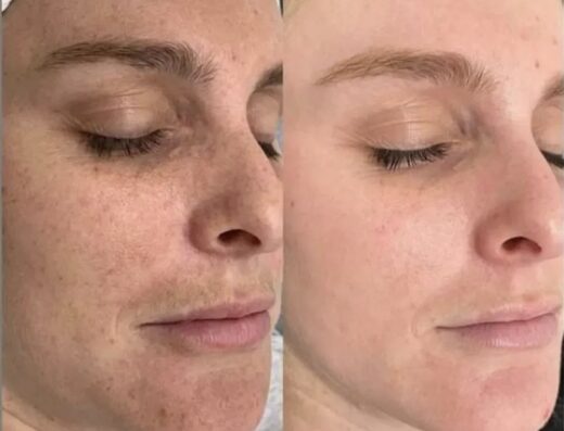 Soins – Ruby Esthétique